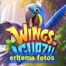 eritema fotos